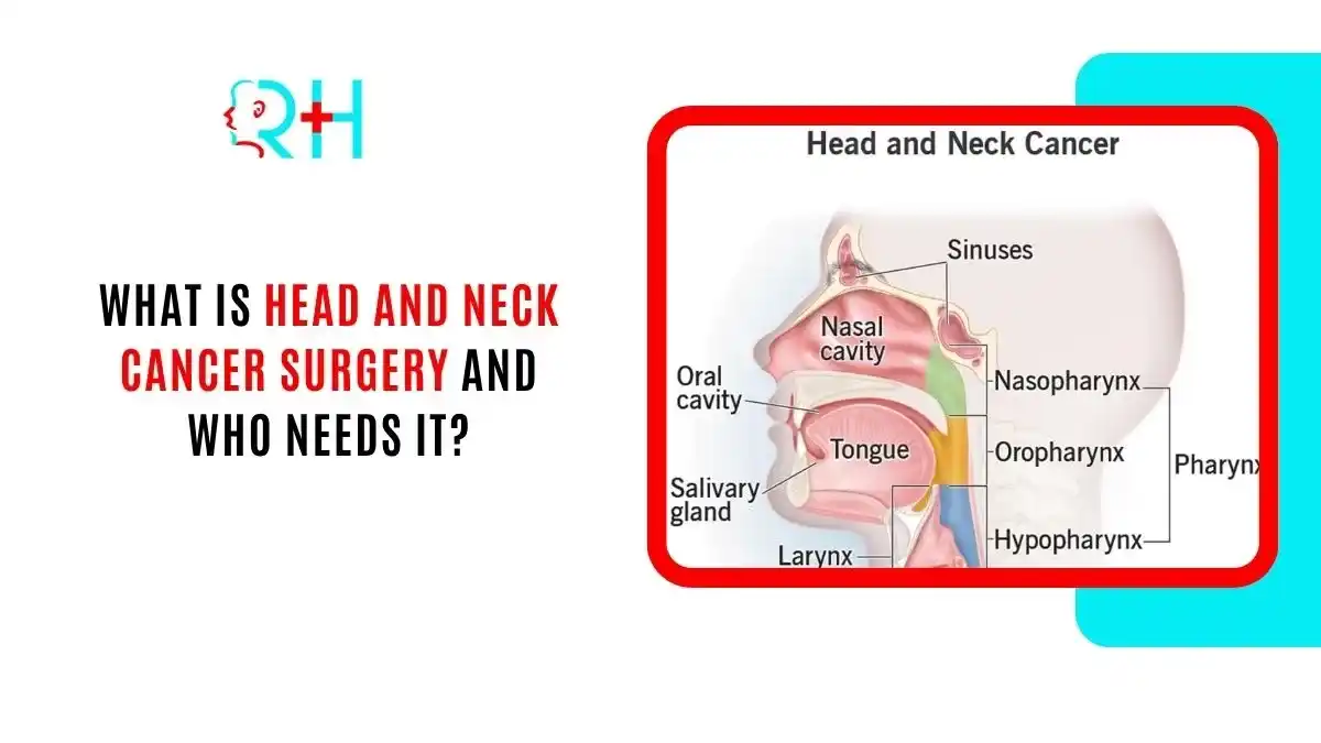 What Is Head and Neck Cancer Surgery and Who Needs It?