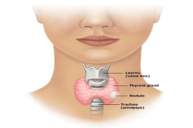 Thyroid