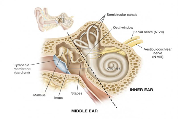 Stapedectomy